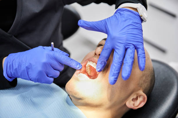 Best Knocked-Out Tooth (Avulsed Tooth) Treatment in Hillsdale, NJ
